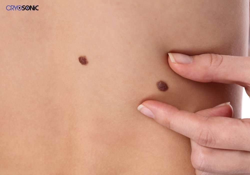 Infection Risk and Poor Aftercare Waltham-Abbey