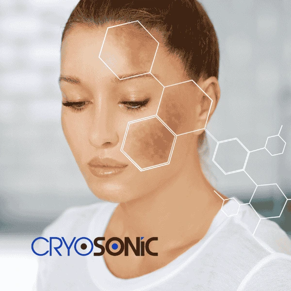 Are you looking for age spot removal treatment? Contact Cryosonic today in Waltham-Abbey