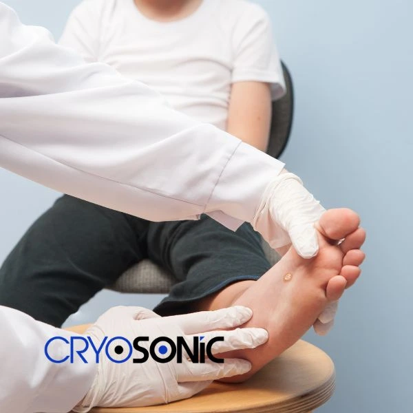 Are you looking for fast effective wart removal Contact us today Waltham-Abbey