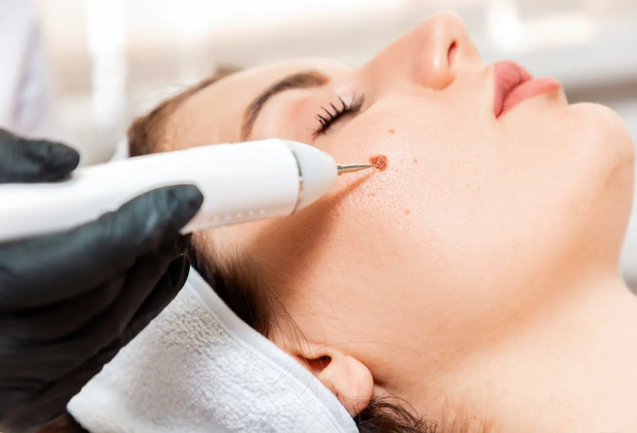 Frequently Asked Questions About Multiple Cryotherapy Treatments Waltham-Abbey