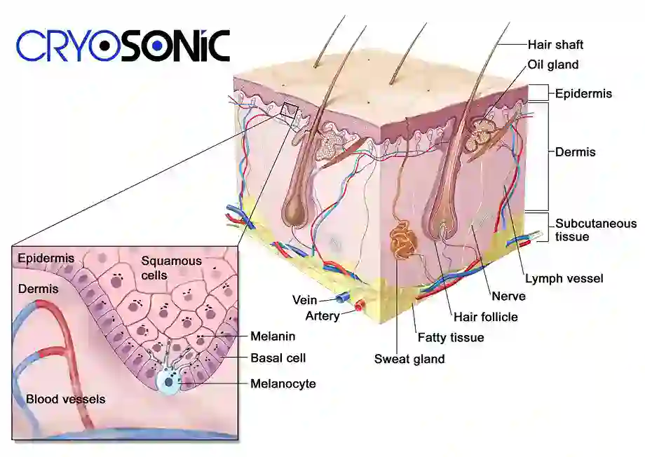 How Cryotherapy Stimulates Melanocyte Activity Waltham-Abbey